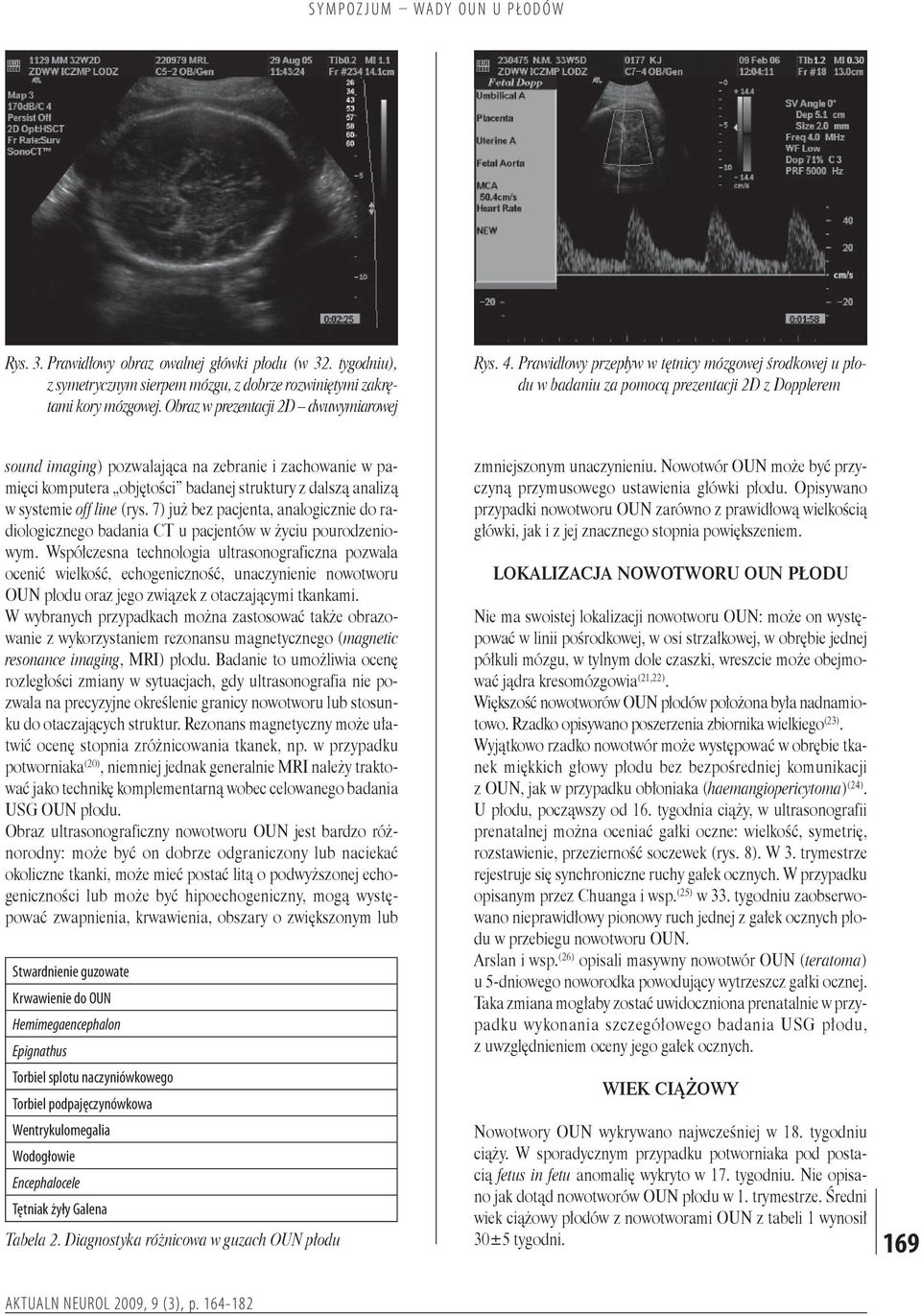struktury z dalszą ana lizą w systemie off line (rys. 7) już bez pacjenta, analogicznie do radiologicznego badania CT u pacjentów w życiu pourodzeniowym.