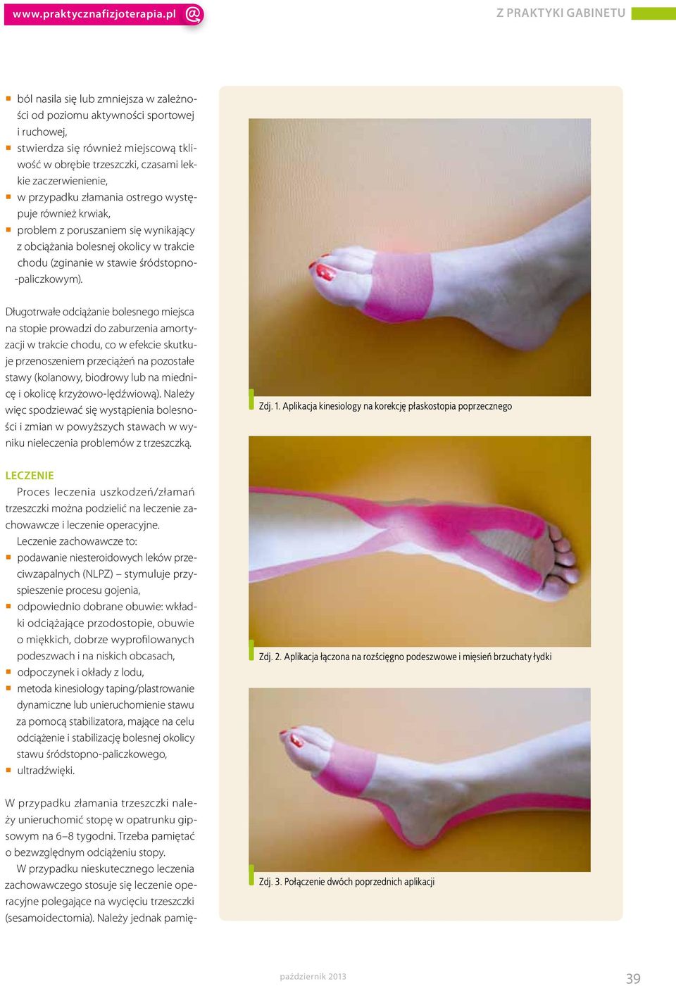 Długotrwałe odciążanie bolesnego miejsca na stopie prowadzi do zaburzenia amortyzacji w trakcie chodu, co w efekcie skutkuje przenoszeniem przeciążeń na pozostałe stawy (kolanowy, biodrowy lub na