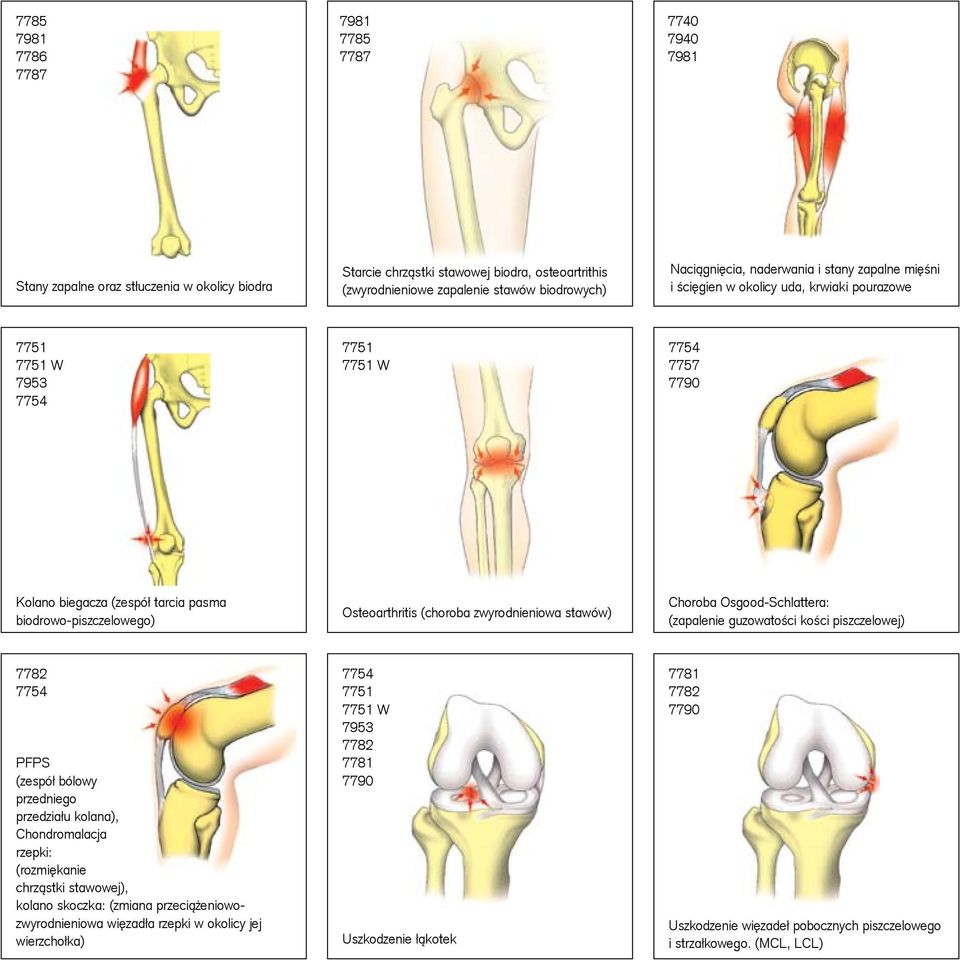 biodrowo-piszczelowego) Osteoarthritis (choroba zwyrodnieniowa stawów) Choroba Osgood-Schlattera: (zapalenie guzowatości kości piszczelowej) 7782 7754 PFPS (zespół bólowy przedniego przedziału