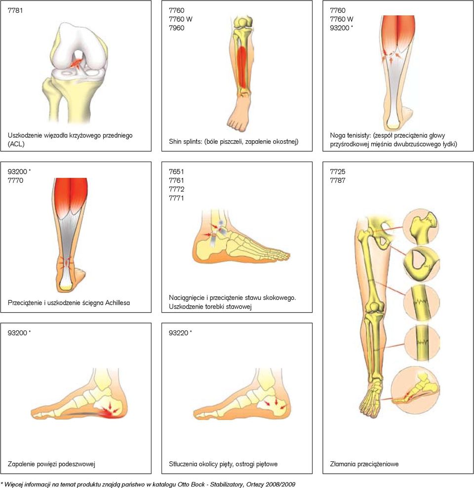 ścięgna Achillesa Naciągnięcie i przeciążenie stawu skokowego.