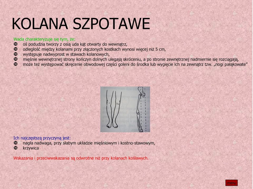 nadmiernie się rozciągają, ❿ może też występować skręcenie obwodowej części goleni do środka lub wygięcie ich na zewnątrz tzw.