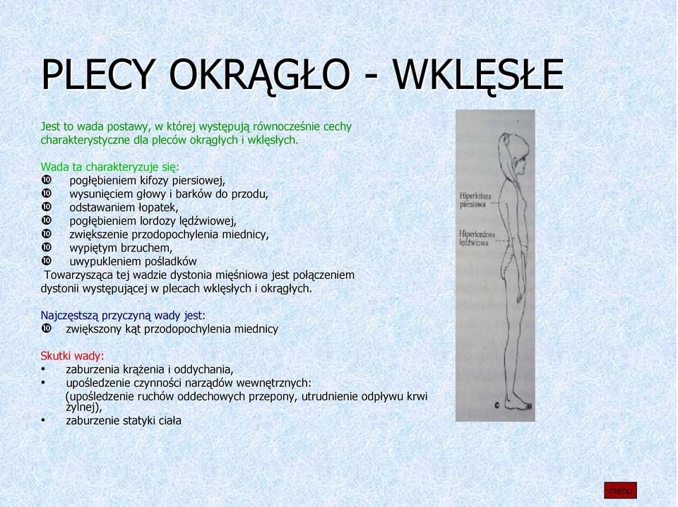 przodopochylenia miednicy, ❿ wypiętym brzuchem, ❿ uwypukleniem pośladk ladków Towarzysząca tej wadzie dystonia mięś ęśniowa jest połą łączeniem dystonii występuj pującej w plecach wklęsłych i