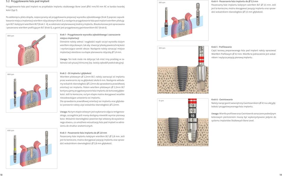 przygotowanie łoża pod implant wiertłem pilotującym BLT i kolejnymi wiertłami BLT (Krok 2-4), w zależności od planowanej średnicy implantu.