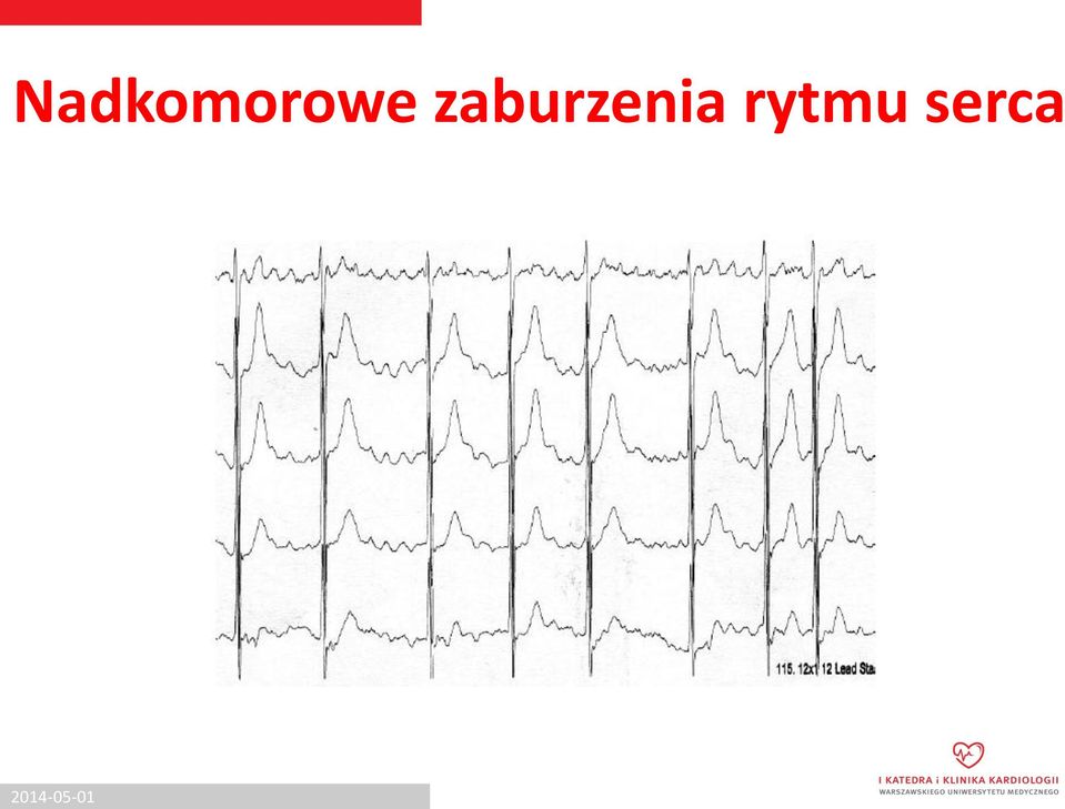 rytmu serca