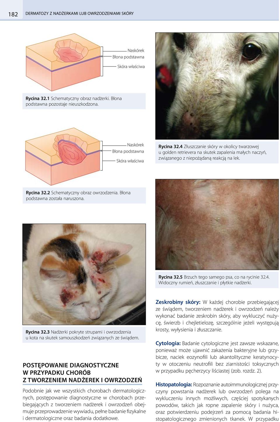 Błona podstawna została naruszona. Rycina 32.5 Brzuch tego samego psa, co na rycinie 32.4. Widoczny rumień, złuszczanie i płytkie nadżerki. Rycina 32.3 Nadżerki pokryte strupami i owrzodzenia u kota na skutek samouszkodzeń związanych ze świądem.