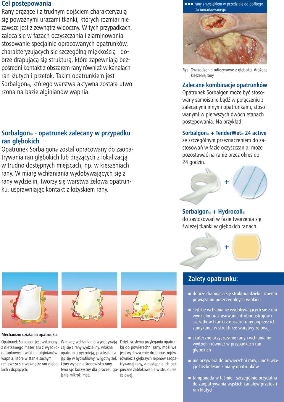 które zapewniają bezpośredni kontakt z obszarem rany również w kanałach ran kłutych i przetok. Takim opatrunkiem jest Sorbalgon, którego warstwa aktywna została utworzona na bazie alginianów wapnia.