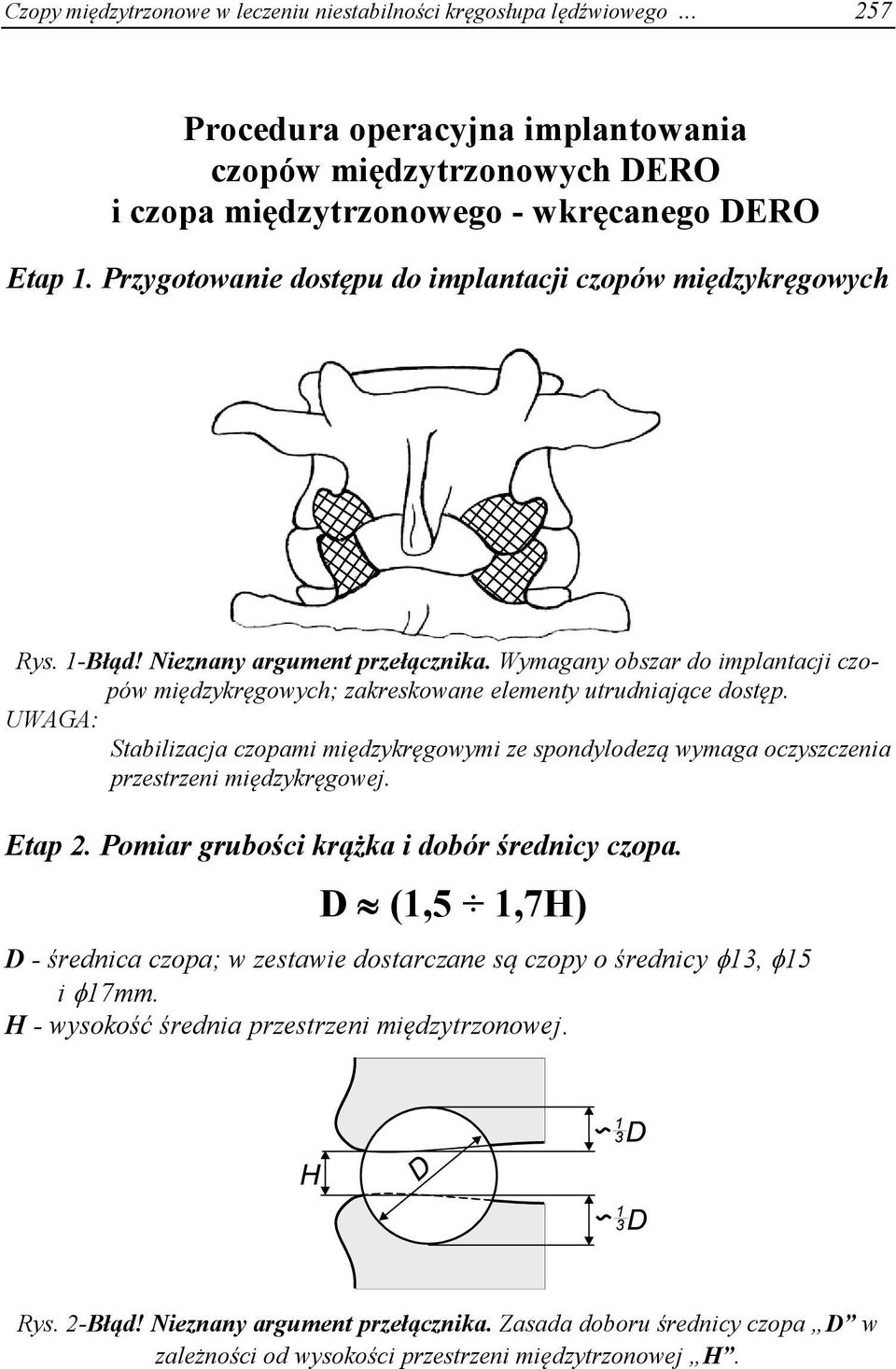 Wymagany obszar do implantacji czopów międzykręgowych; zakreskowane elementy utrudniające dostęp. Stabilizacja czopami międzykręgowymi ze spondylodezą wymaga oczyszczenia przestrzeni międzykręgowej.