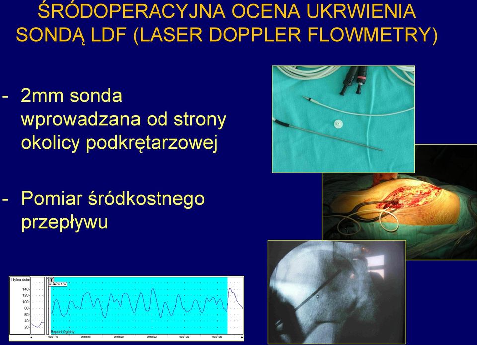 sonda wprowadzana od strony okolicy