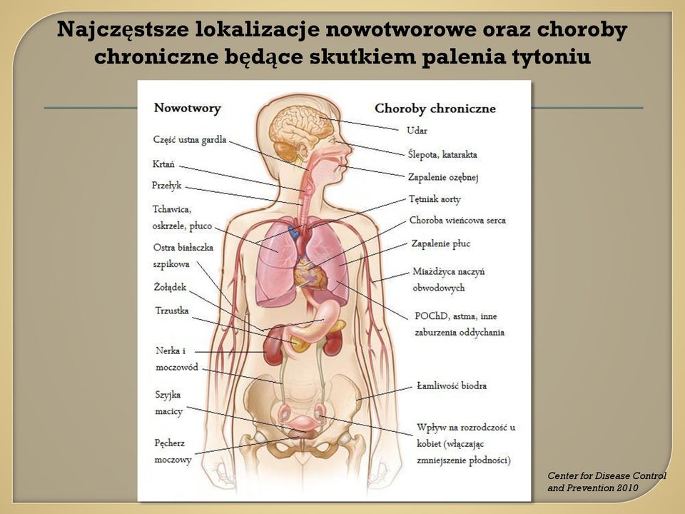 chroniczne będące skutkiem palenia
