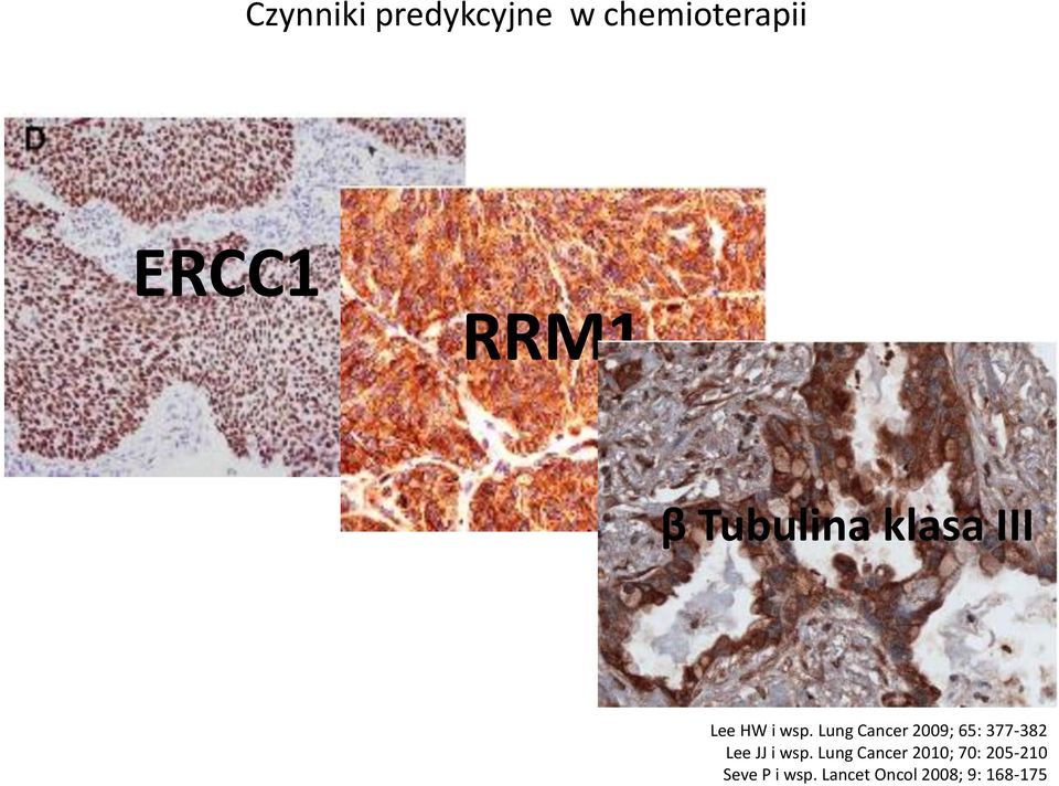 Lung Cancer 2009; 65: 377-382 Lee JJ i wsp.