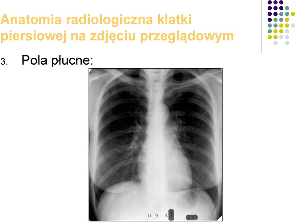 klatki piersiowej