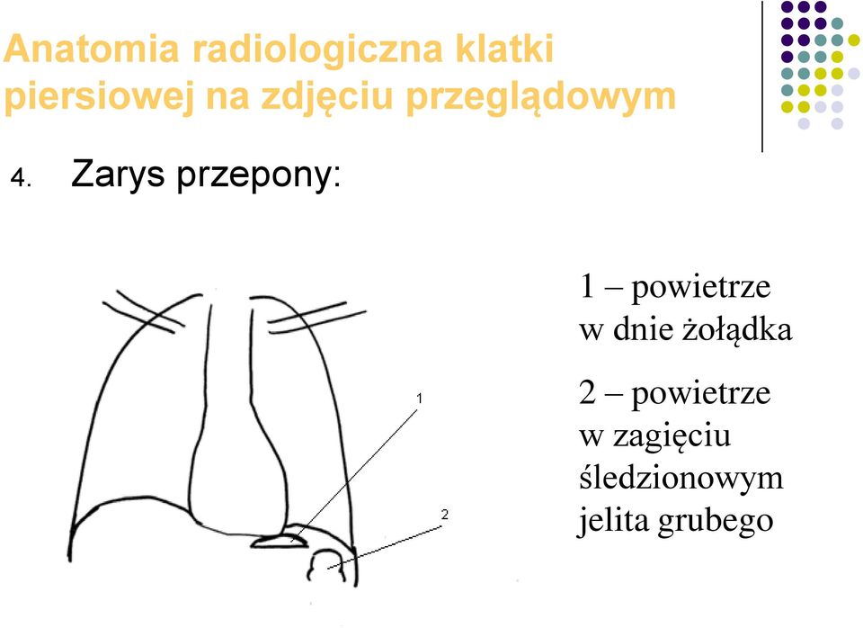 Zarys przepony: 1 powietrze w dnie