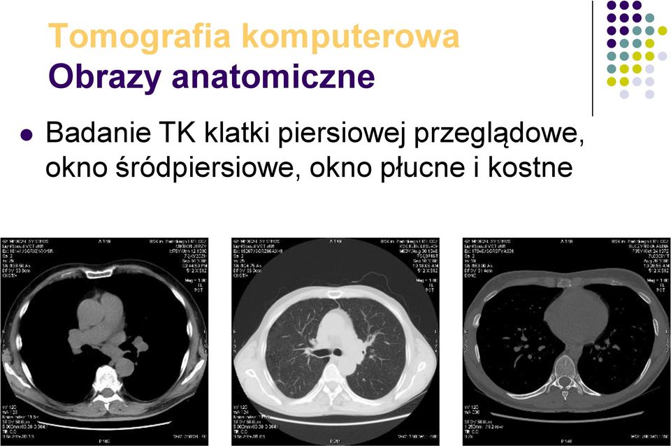 piersiowej przeglądowe, okno