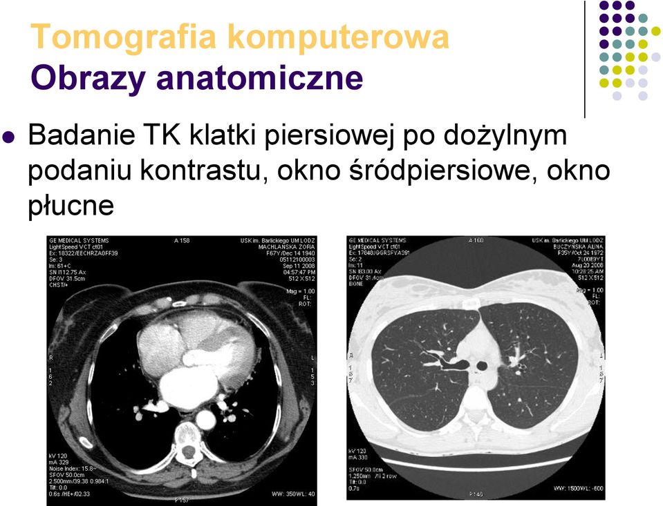 piersiowej po dożylnym podaniu