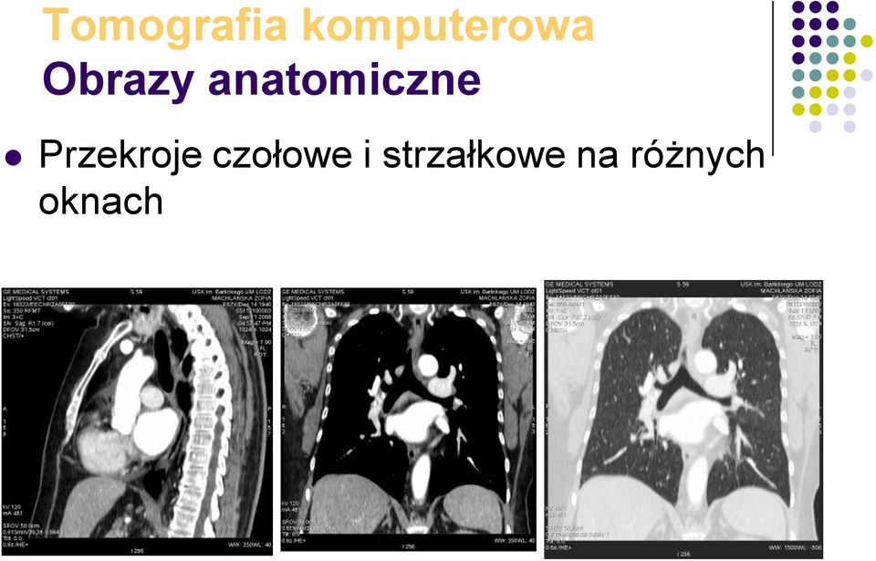 Przekroje czołowe i