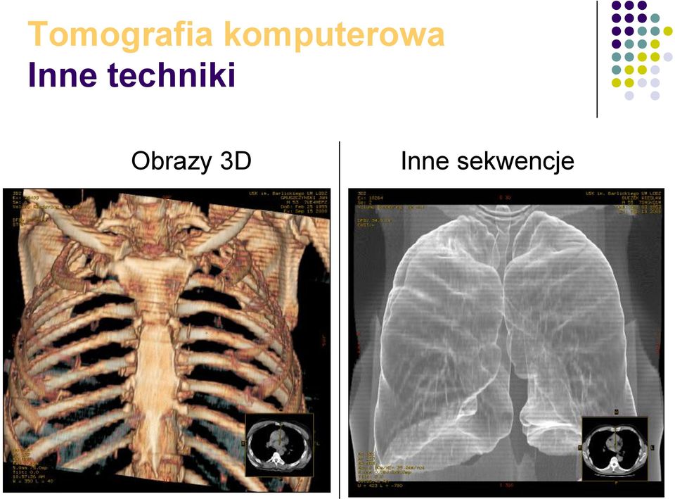 Inne techniki