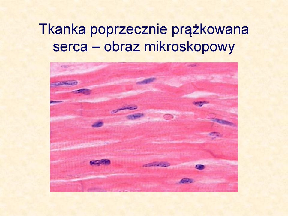 prążkowana