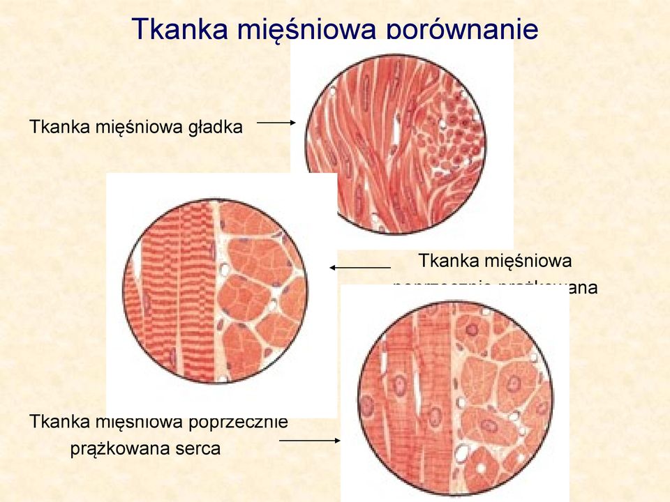 poprzecznie prążkowana Tkanka