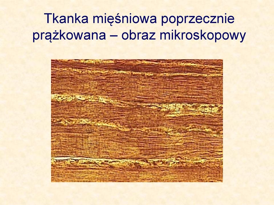 poprzecznie