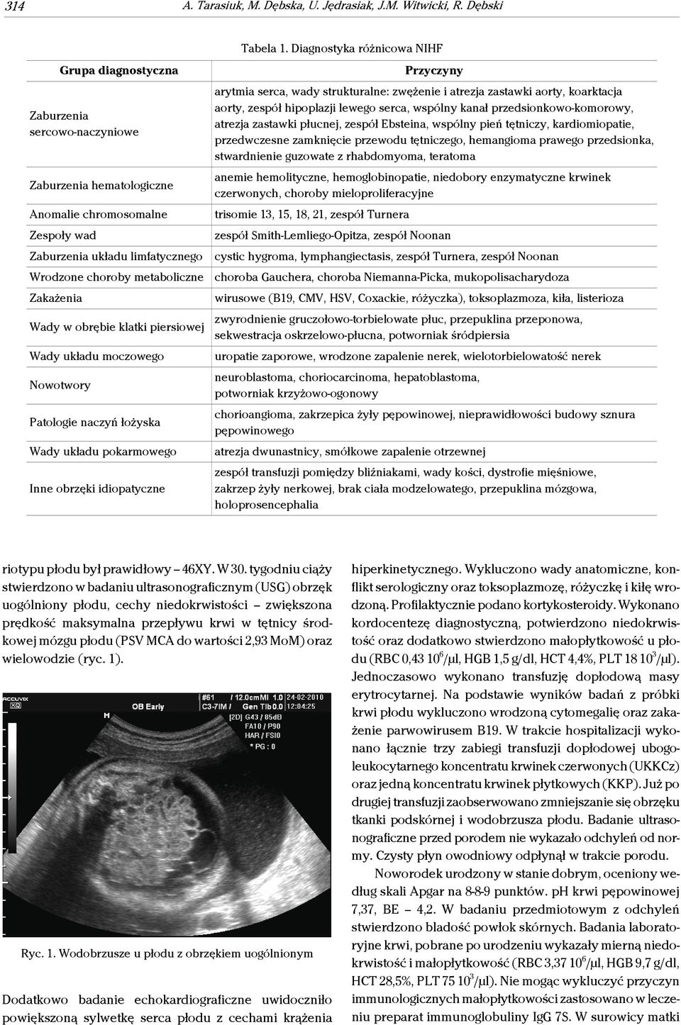obrębie klatki piersiowej Wady układu moczowego Nowotwory Patologie naczyń łożyska Wady układu pokarmowego Inne obrzęki idiopatyczne Tabela 1.