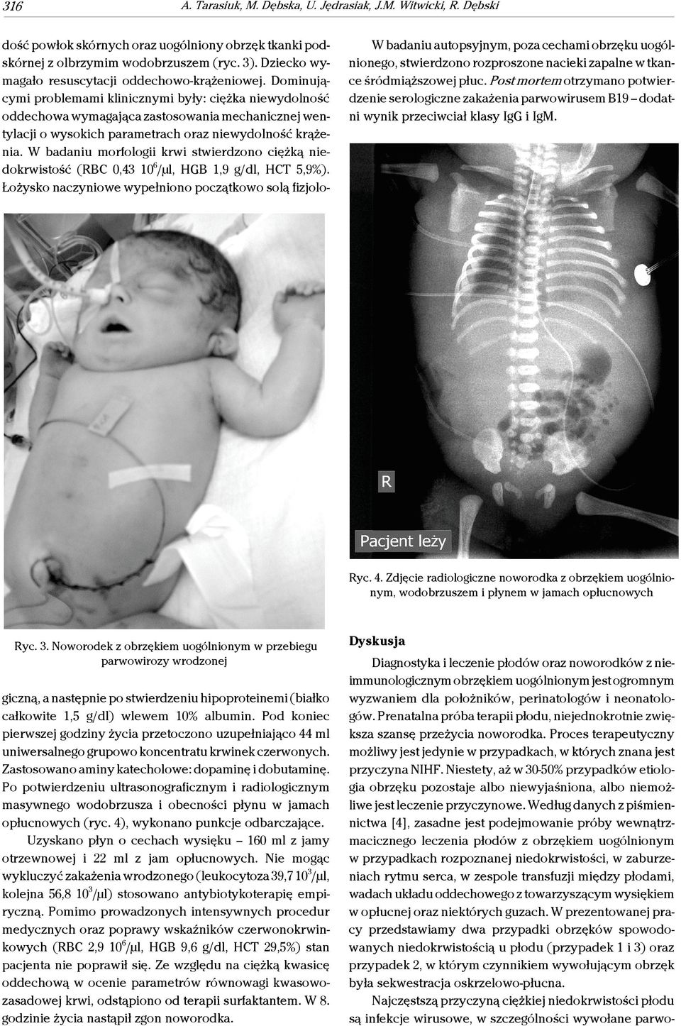 Dominującymi problemami klinicznymi były: ciężka niewydolność oddechowa wymagająca zastosowania mechanicznej wentylacji o wysokich parametrach oraz niewydolność krążenia.
