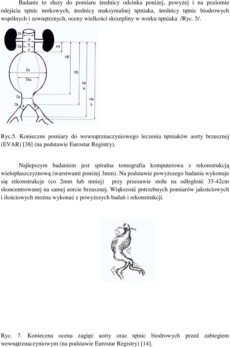 Najlepszym badaniem jest spiralna tomografia komputerowa z rekonstrukcją wielopłaszczyznową (warstwami poniŝej 3mm).