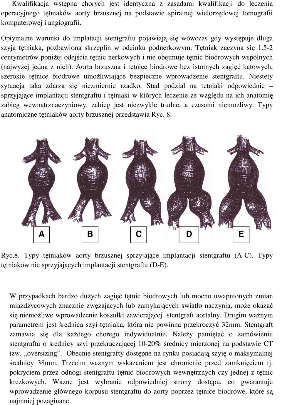 5-2 centymetrów poniŝej odejścia tętnic nerkowych i nie obejmuje tętnic biodrowych wspólnych (najwyŝej jedną z nich).