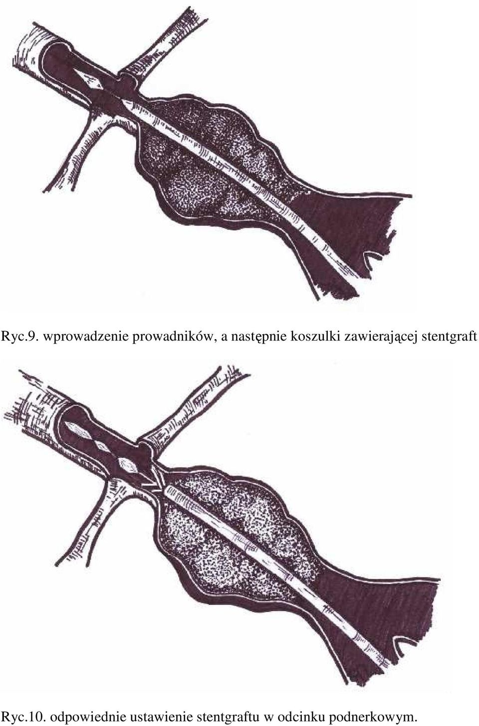 następnie koszulki zawierającej