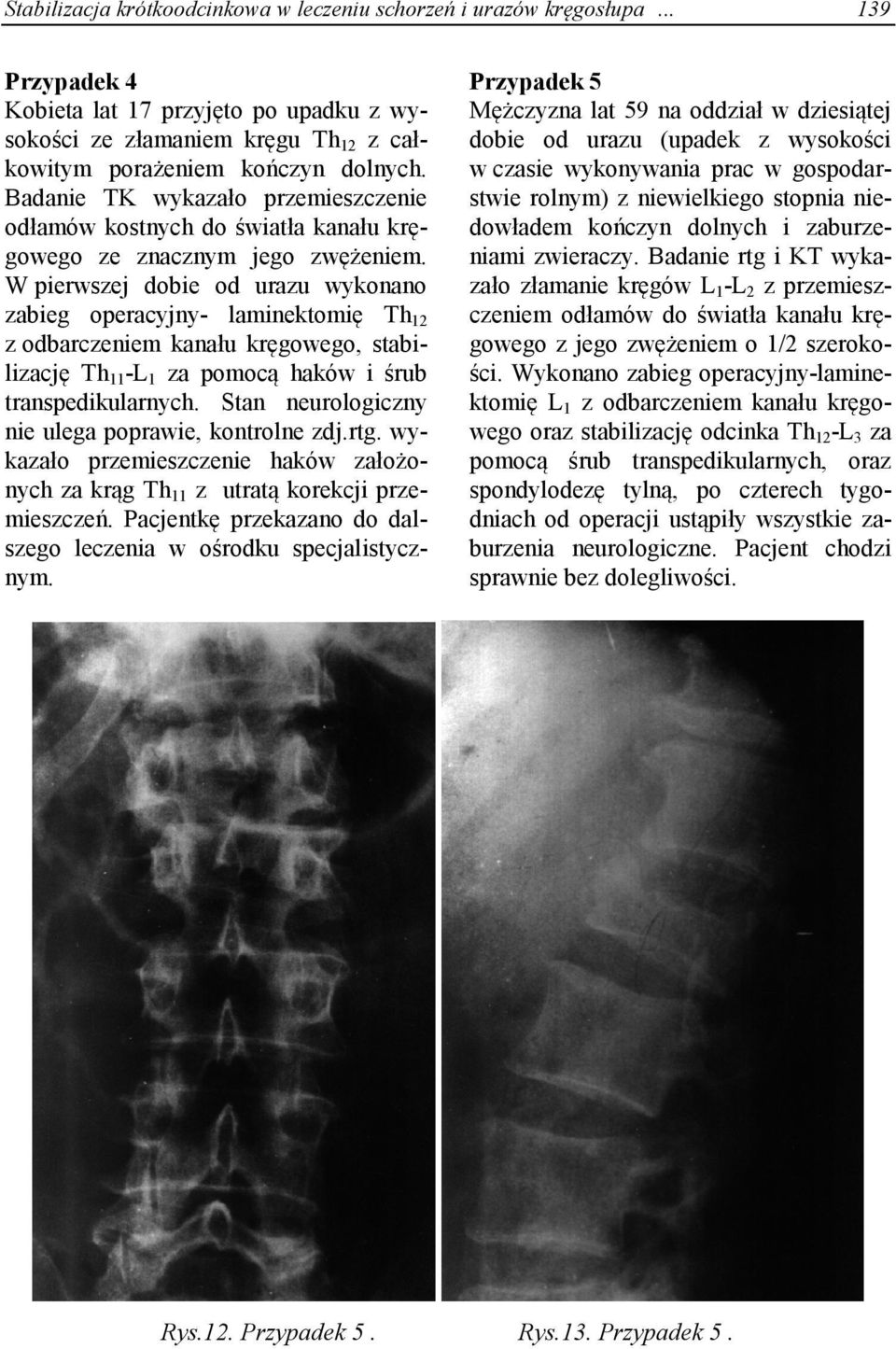 W pierwszej dobie od urazu wykonano zabieg operacyjny- laminektomię Th 12 z odbarczeniem kanału kręgowego, stabilizację Th 11 -L 1 za pomocą haków i śrub transpedikularnych.