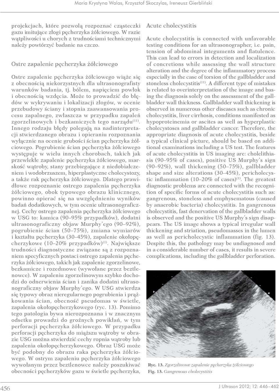 Ostre zapalenie pęcherzyka żółciowego Ostre zapalenie pęcherzyka żółciowego wiąże się z obecnością niekorzystnych dla ultrasonografisty warunków badania, tj.
