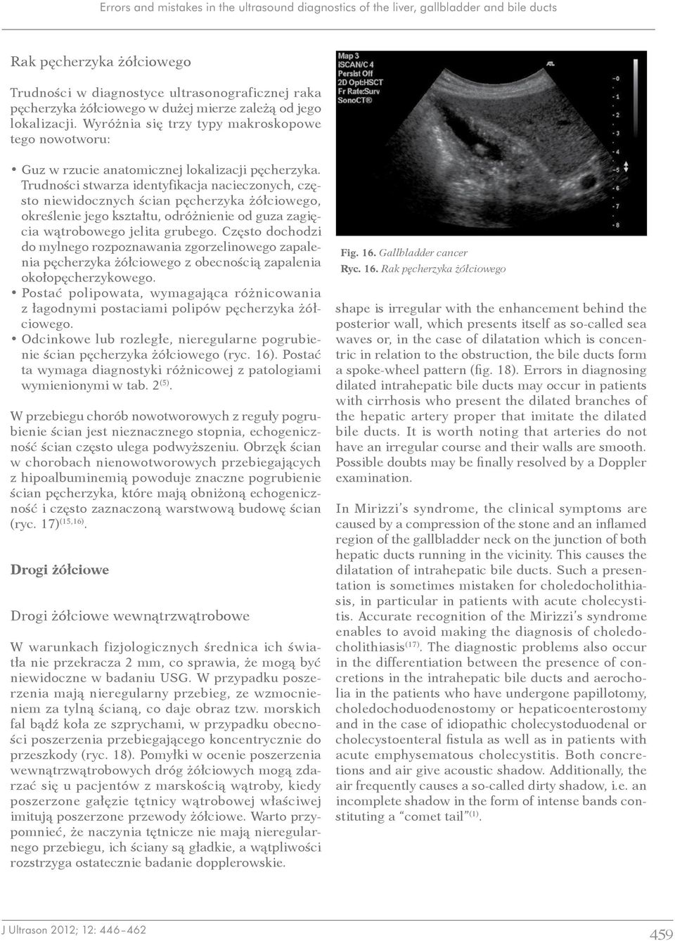 Trudności stwarza identyfikacja nacieczonych, często niewidocznych ścian pęcherzyka żółciowego, określenie jego kształtu, odróżnienie od guza zagięcia wątrobowego jelita grubego.