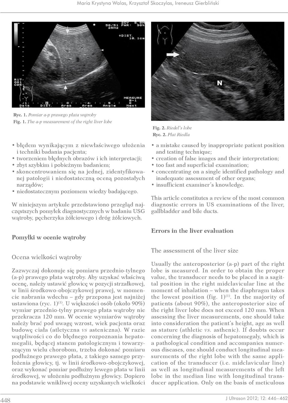 The a-p measurement of the right liver lobe błędem wynikającym z niewłaściwego ułożenia i techniki badania pacjenta; tworzeniem błędnych obrazów i ich interpretacji; zbyt szybkim i pobieżnym