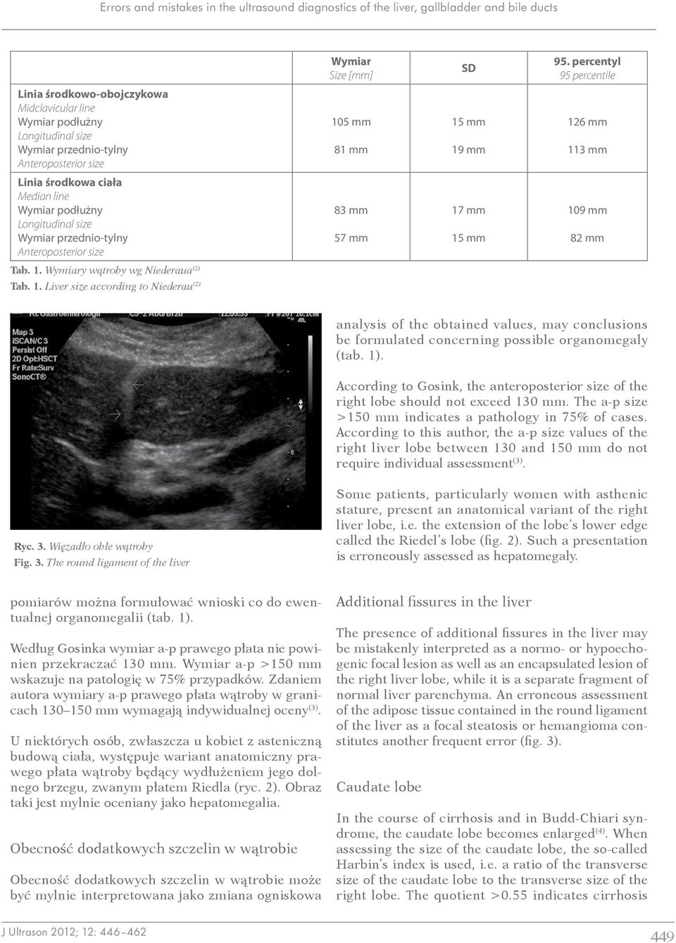 Longitudinal size Wymiar przednio tylny Anteroposterior size Tab. 1.