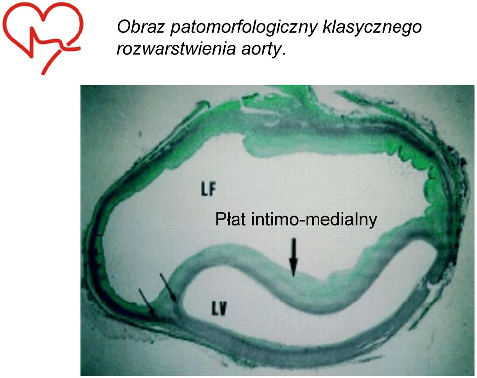 klasycznego