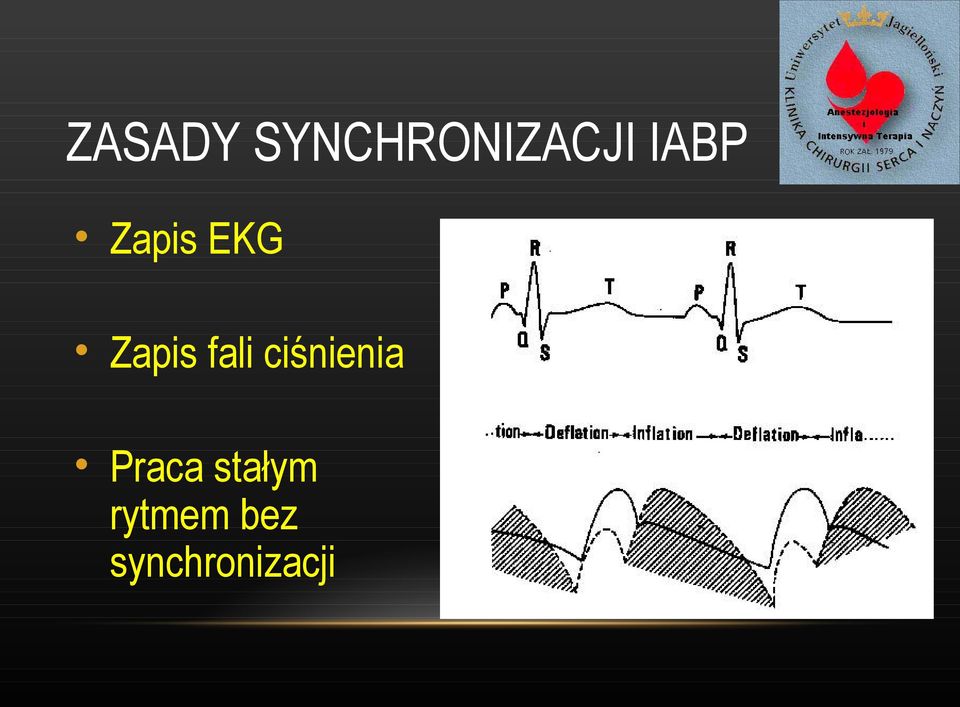 fali ciśnienia Praca