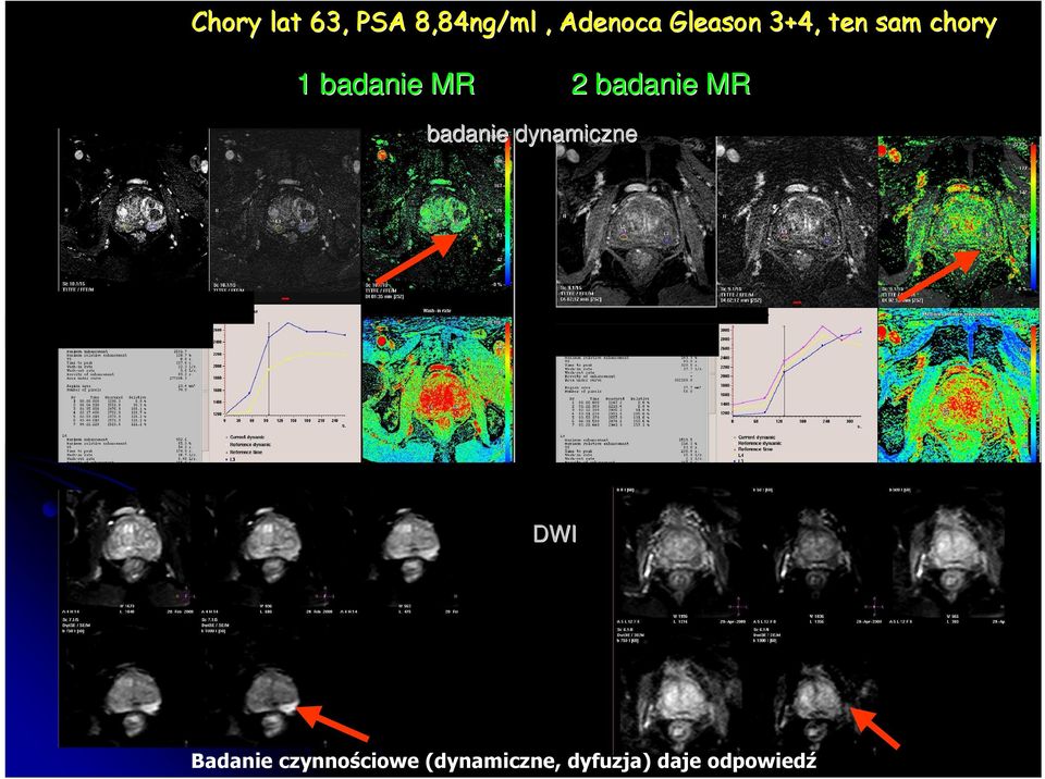 badanie MR badanie dynamiczne DWI Badanie