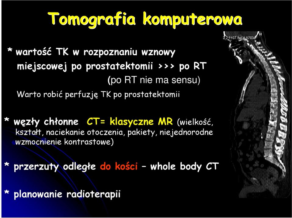 chłonne CT= klasyczne MR (wielkość, kształt, naciekanie otoczenia, pakiety,