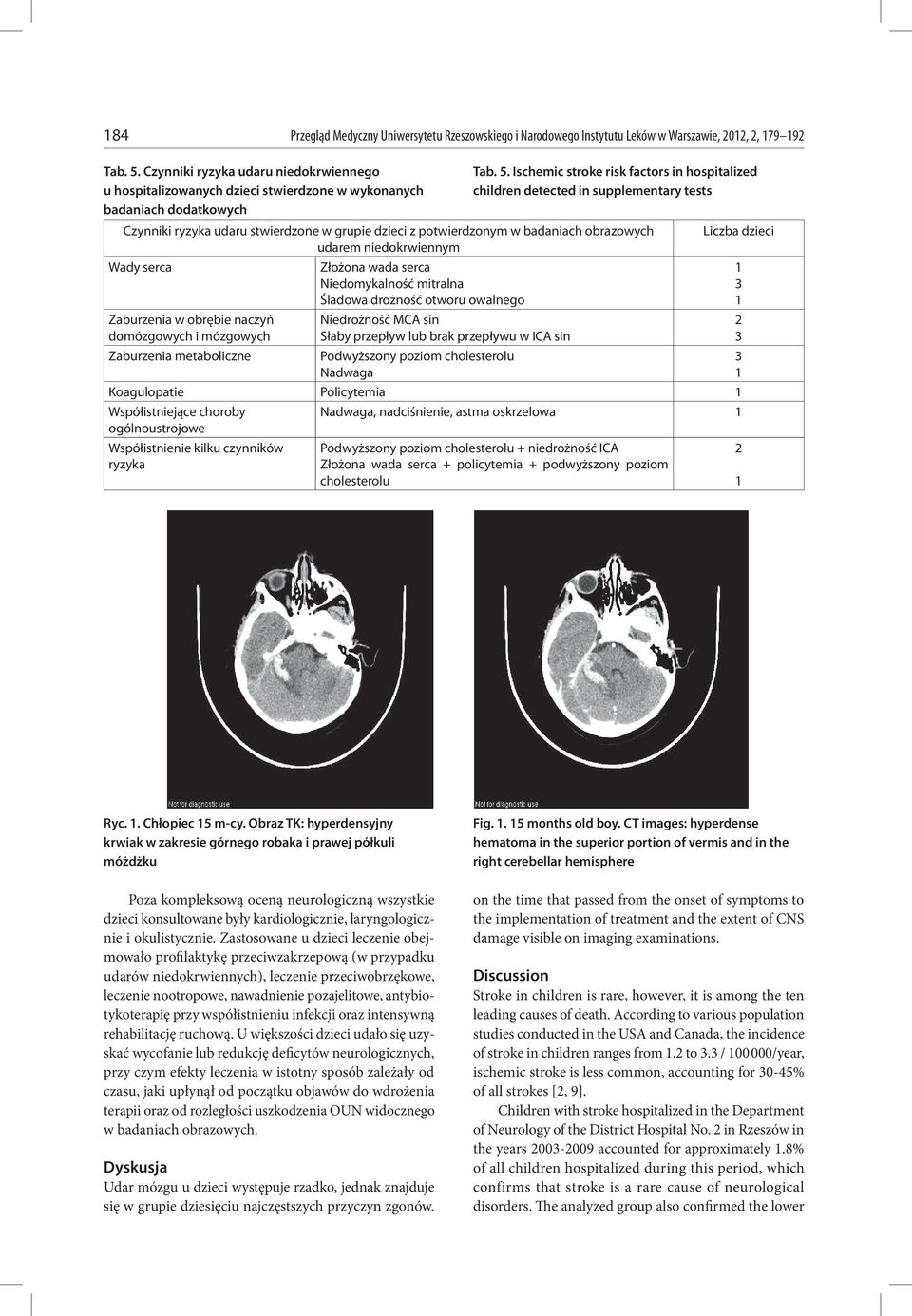 Ischemic stroke risk factors in hospitalized children detected in supplementary tests Czynniki ryzyka udaru stwierdzone w grupie dzieci z potwierdzonym w badaniach obrazowych udarem niedokrwiennym