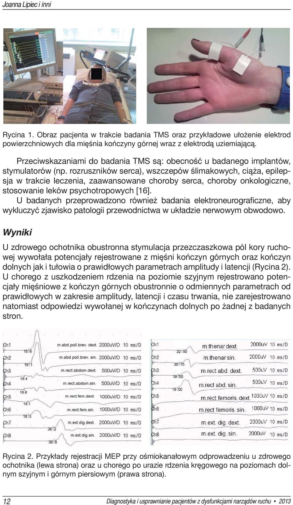 rozruszników serca), wszczepów ślimakowych, ciąża, epilepsja w trakcie leczenia, zaawansowane choroby serca, choroby onkologiczne, stosowanie leków psychotropowych [16].