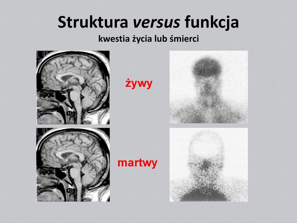 kwestia życia