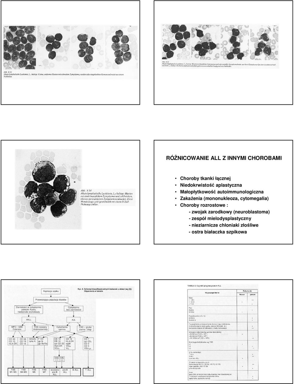 cytomegalia) Choroby rozrostowe : - zwojak zarodkowy (neuroblastoma) -