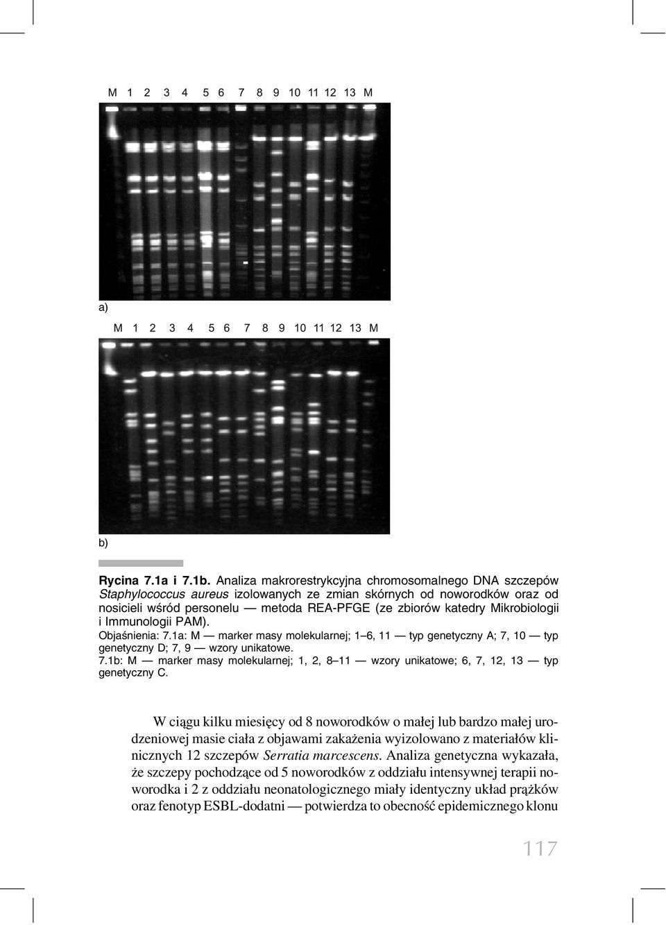 Mikrobiologii i Immunologii PAM). Objaśnienia: 7.1a: M marker masy molekularnej; 1 6, 11 typ genetyczny A; 7, 10 typ genetyczny D; 7, 9 wzory unikatowe. 7.1b: M marker masy molekularnej; 1, 2, 8 11 wzory unikatowe; 6, 7, 12, 13 typ genetyczny C.