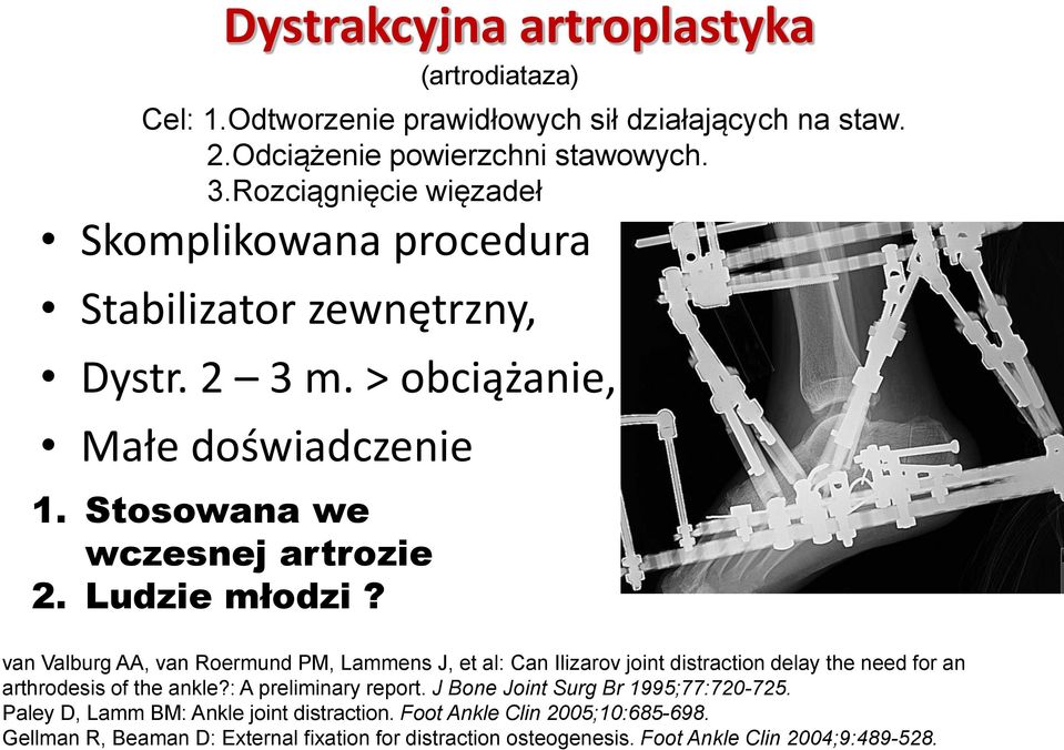 Ludzie młodzi? (artrodiataza) van Valburg AA, van Roermund PM, Lammens J, et al: Can Ilizarov joint distraction delay the need for an arthrodesis of the ankle?