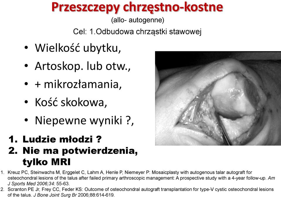 Kreuz PC, Steinwachs M, Erggelet C, Lahm A, Henle P, Niemeyer P: Mosaicplasty with autogenous talar autograft for osteochondral lesions of the talus after failed