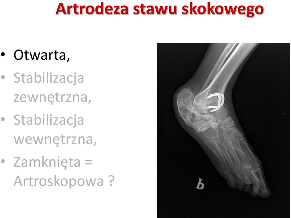 zewnętrzna, Stabilizacja