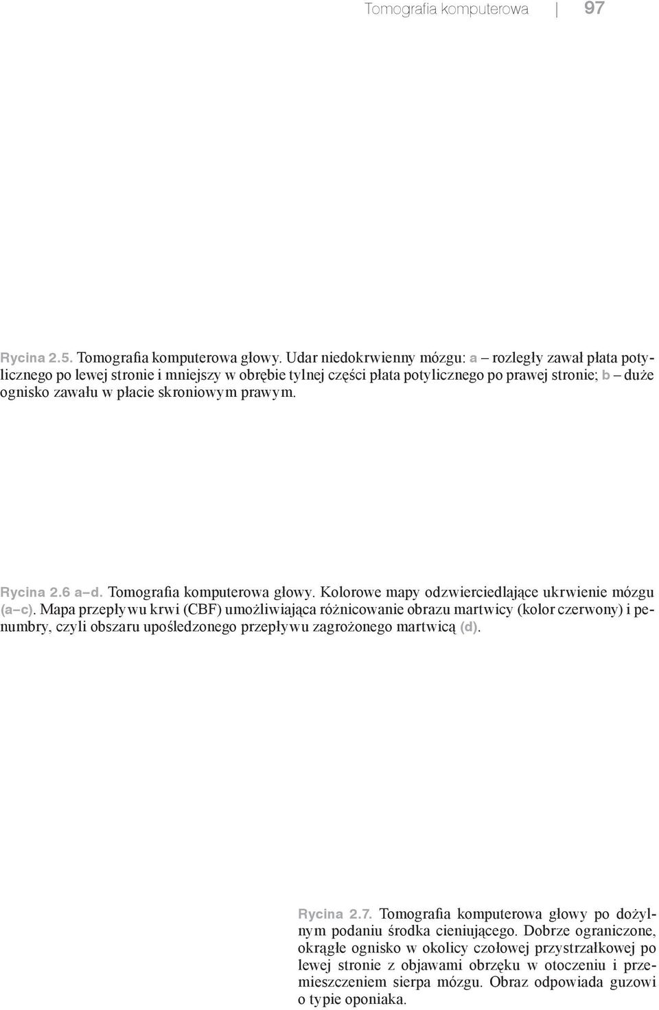 prawym. a b c d Rycina 2.6 a d. Tomografia komputerowa głowy. Kolorowe mapy odzwierciedlające ukrwienie mózgu (a c).