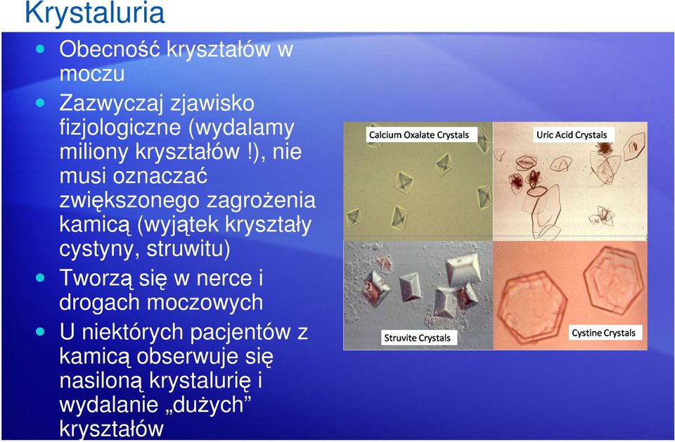 ), nie musi oznaczać zwiększonego zagrożenia kamicą (wyjątek kryształy cystyny,