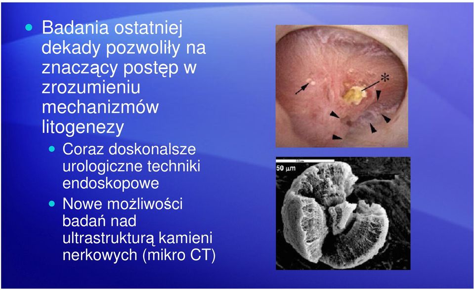 doskonalsze urologiczne techniki endoskopowe Nowe