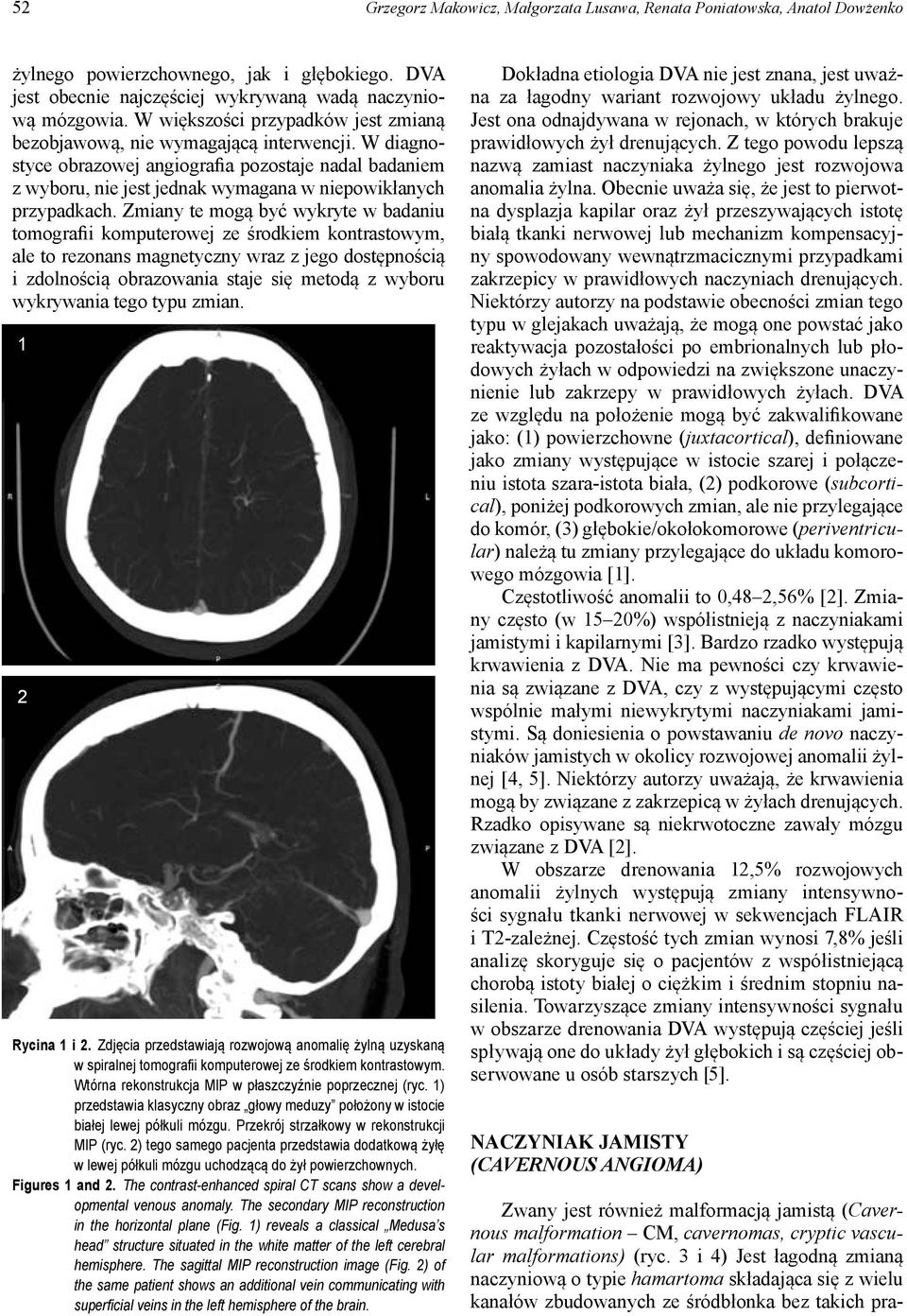 W diagnostyce obrazowej angiografia pozostaje nadal badaniem z wyboru, nie jest jednak wymagana w niepowikłanych przypadkach.