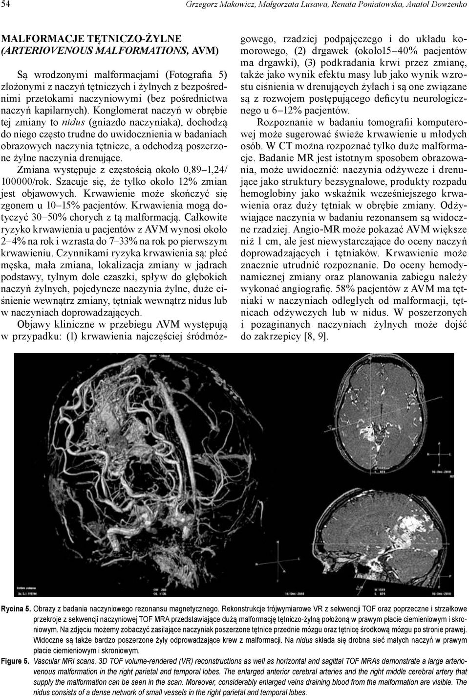 Konglomerat naczyń w obrębie tej zmiany to nidus (gniazdo naczyniaka), dochodzą do niego często trudne do uwidocznienia w badaniach obrazowych naczynia tętnicze, a odchodzą poszerzone żylne naczynia